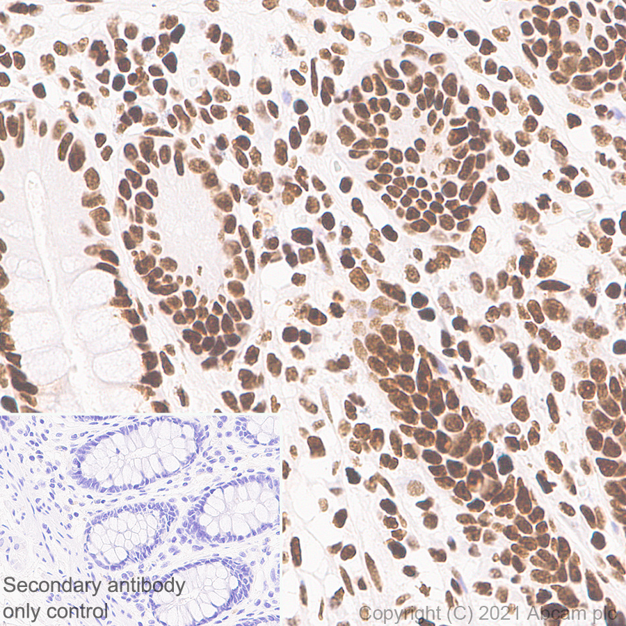 Immunohistochemistry (Formalin/PFA-fixed paraffin-embedded sections) - Anti-Histone H3 (tri methyl K36) antibody [EPR23525-232] - BSA and Azide free (AB282596)