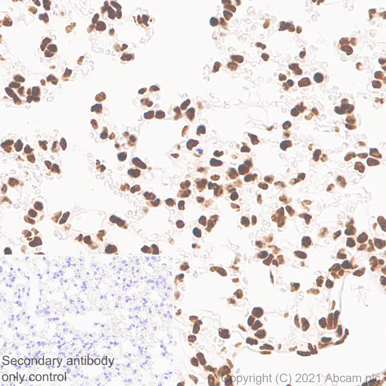 Immunohistochemistry (Formalin/PFA-fixed paraffin-embedded sections) - Anti-Histone H3 (tri methyl K36) antibody [EPR23525-232] - BSA and Azide free (AB282596)