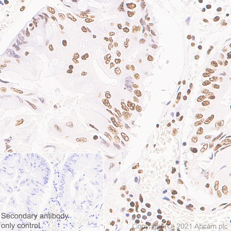 Immunohistochemistry (Formalin/PFA-fixed paraffin-embedded sections) - Anti-Histone H3 (tri methyl K36) antibody [EPR23525-232] - ChIP Grade (AB282572)