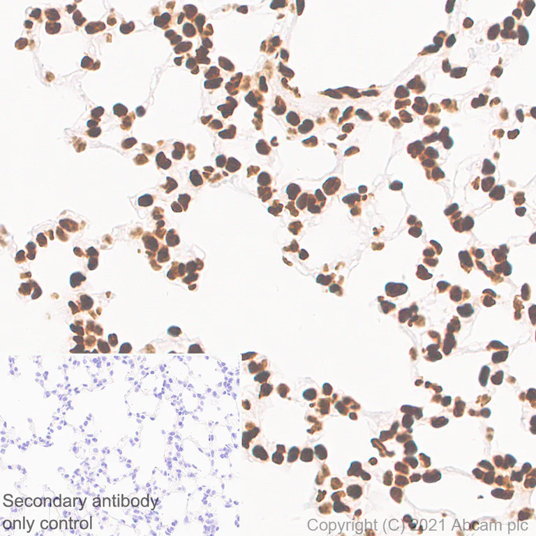 Immunohistochemistry (Formalin/PFA-fixed paraffin-embedded sections) - Anti-Histone H3 (tri methyl K36) antibody [EPR23525-232] - ChIP Grade (AB282572)