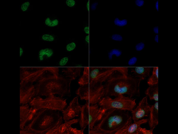 Immunocytochemistry/ Immunofluorescence - Anti-Histone H3 (tri methyl K4, acetyl K9) antibody (AB272164)