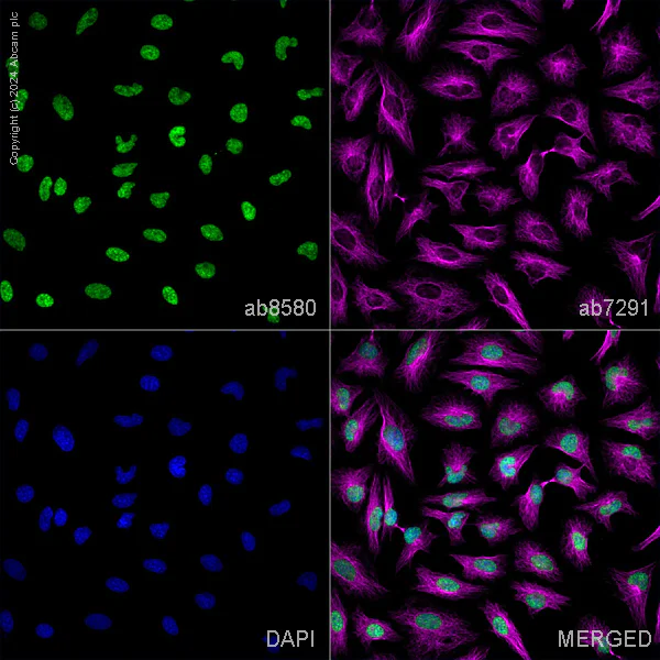 Immunocytochemistry/ Immunofluorescence - Anti-Histone H3 (tri methyl K4) antibody - ChIP Grade (AB8580)
