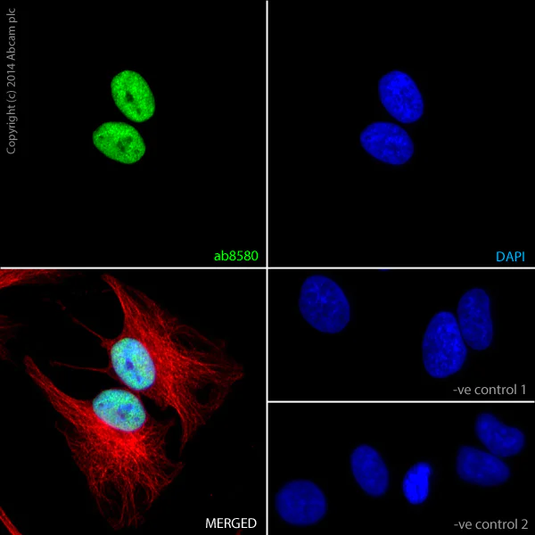 Immunocytochemistry/ Immunofluorescence - Anti-Histone H3 (tri methyl K4) antibody - ChIP Grade (AB8580)