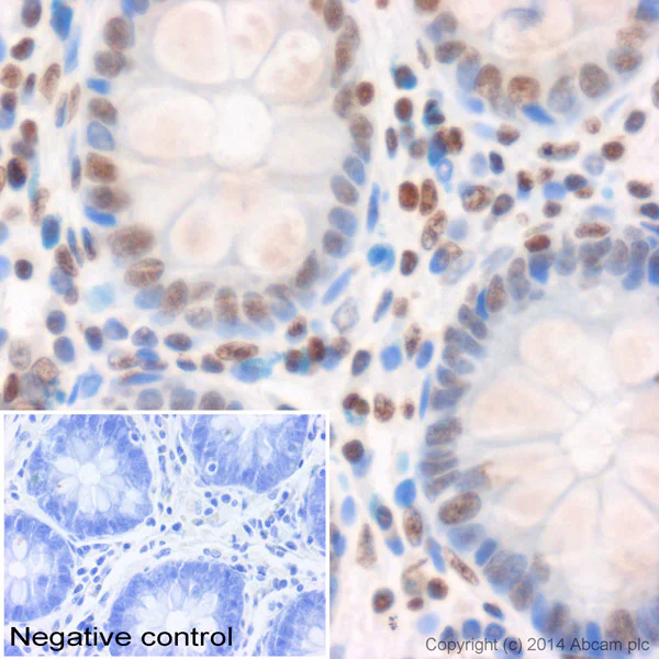 Immunohistochemistry (Formalin/PFA-fixed paraffin-embedded sections) - Anti-Histone H3 (tri methyl K4) antibody - ChIP Grade (AB8580)