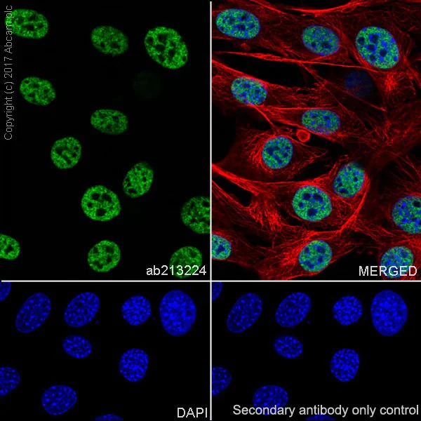 Immunocytochemistry/ Immunofluorescence - Anti-Histone H3 (tri methyl K4) antibody [EPR20551-225] - ChIP Grade (AB213224)