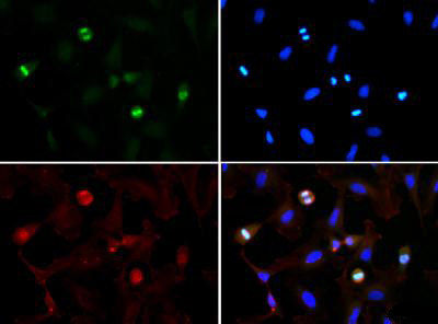 Immunofluorescence - Anti-Histone H3 (tri methyl K56) antibody (AB272162), expandable thumbnail
