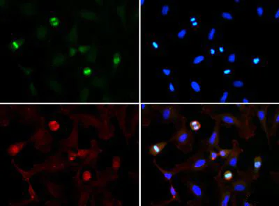 Immunofluorescence - Anti-Histone H3 (tri methyl K56) antibody (AB272162)