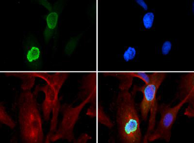 Immunofluorescence - Anti-Histone H3 (tri methyl K56) antibody (AB272162), expandable thumbnail