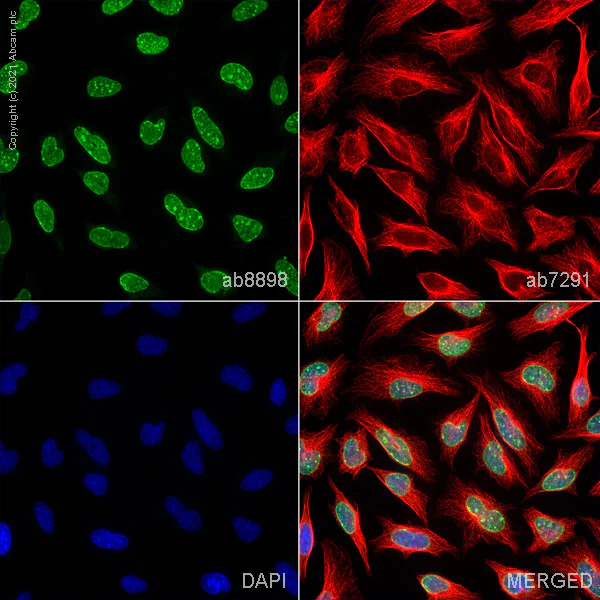 Immunocytochemistry/ Immunofluorescence - Anti-Histone H3 (tri methyl K9) antibody - ChIP Grade (AB8898)