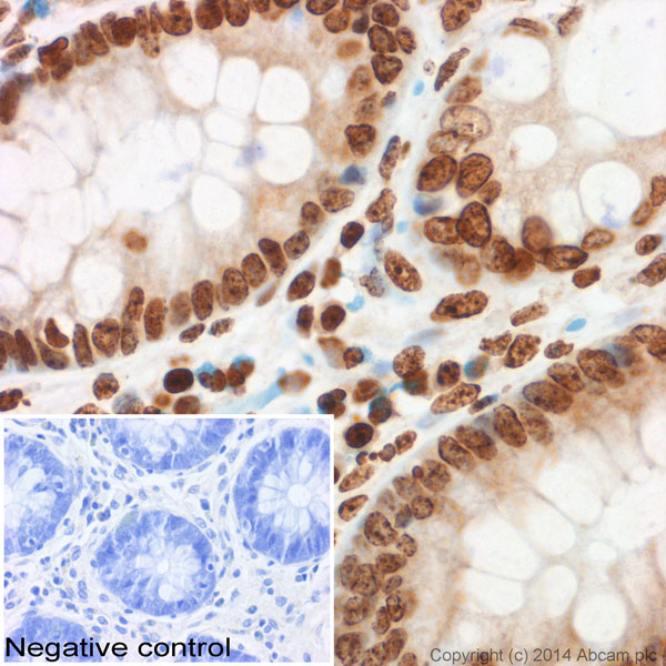 Immunohistochemistry (Formalin/PFA-fixed paraffin-embedded sections) - Anti-Histone H3 (tri methyl K9) antibody - ChIP Grade (AB8898), expandable thumbnail