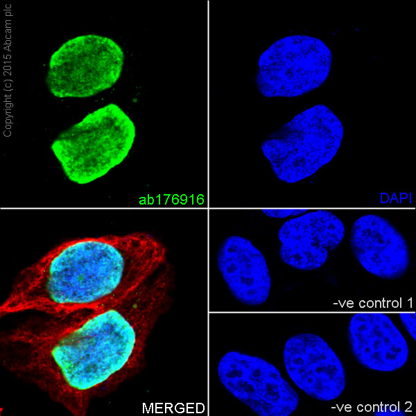 Immunocytochemistry/ Immunofluorescence - Anti-Histone H3 (tri methyl K9) antibody [EPR16601] - ChIP Grade (ab176916), expandable thumbnail