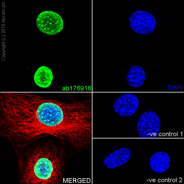 Immunocytochemistry/ Immunofluorescence - Anti-Histone H3 (tri methyl K9) antibody [EPR16601] - ChIP Grade (ab176916), expandable thumbnail