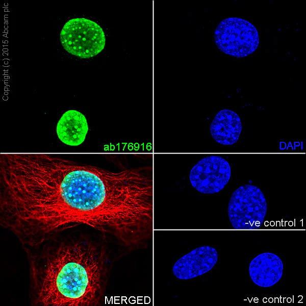 Immunocytochemistry/ Immunofluorescence - Anti-Histone H3 (tri methyl K9) antibody [EPR16601] - ChIP Grade (AB176916)