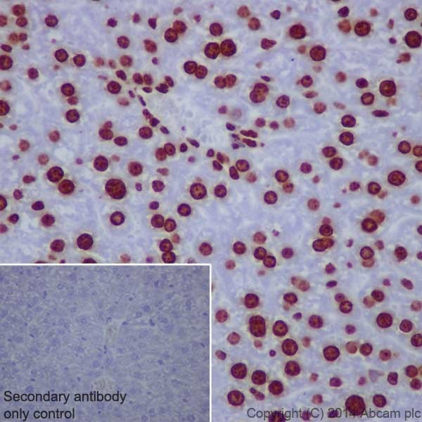 Immunohistochemistry (Formalin/PFA-fixed paraffin-embedded sections) - Anti-Histone H3 (tri methyl K9) antibody [EPR16601] - ChIP Grade (ab176916), expandable thumbnail