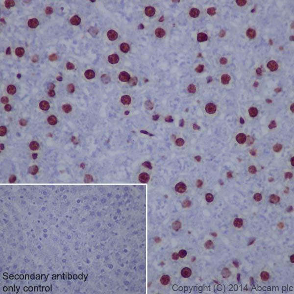 Immunohistochemistry (Formalin/PFA-fixed paraffin-embedded sections) - Anti-Histone H3 (tri methyl K9) antibody [EPR16601] - ChIP Grade (ab176916), expandable thumbnail