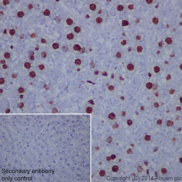 Immunohistochemistry (Formalin/PFA-fixed paraffin-embedded sections) - Anti-Histone H3 (tri methyl K9) antibody [EPR16601] - ChIP Grade (AB176916)