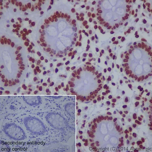 Immunohistochemistry (Formalin/PFA-fixed paraffin-embedded sections) - Anti-Histone H3 (tri methyl K9) antibody [EPR16601] - ChIP Grade (AB176916)