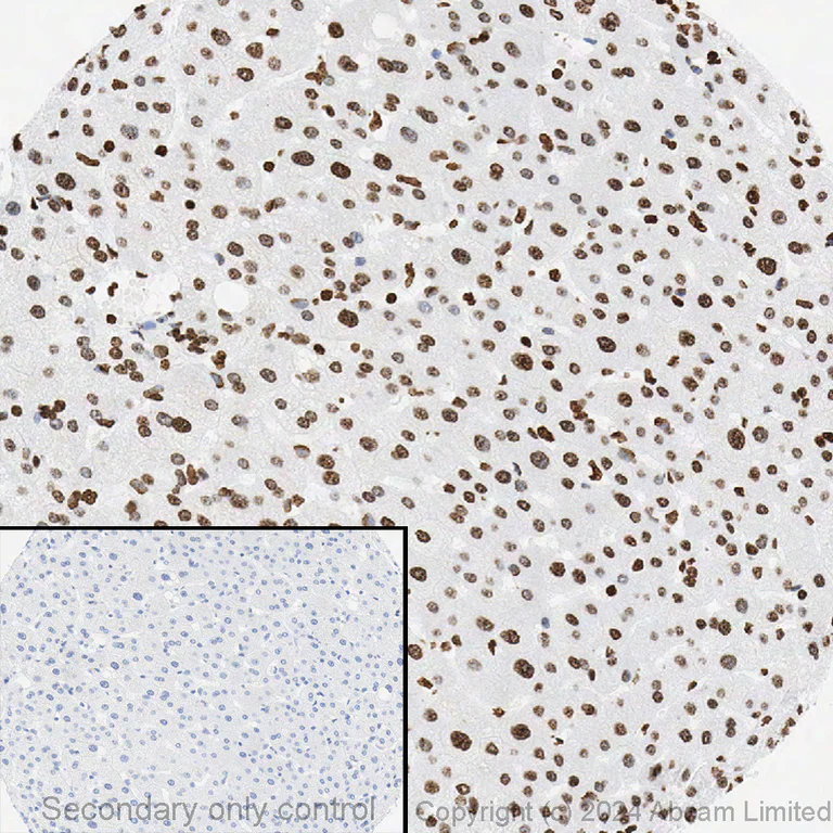 Immunohistochemistry - Anti-Histone H3 (tri methyl K9) antibody [EPR16601] - ChIP Grade (AB176916)
