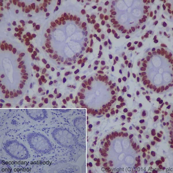 Immunohistochemistry (Formalin/PFA-fixed paraffin-embedded sections) - Anti-Histone H3 (tri methyl K9) antibody [EPR16601] - ChIP Grade - BSA and Azide free (AB232324)