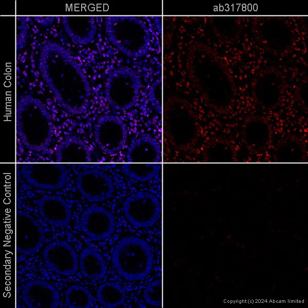 Immunohistochemistry (Formalin/PFA-fixed paraffin-embedded sections) - Anti-Histone H3 (tri methyl K9) antibody [EPR16601] - ChIP Grade – Mouse IgG1 (Chimeric) (AB317790)
