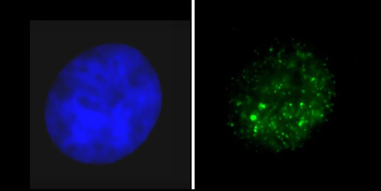 Immunocytochemistry/ Immunofluorescence - Anti-Histone H3 (tri methyl K9, phospho S10) antibody (AB5819)