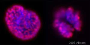 Immunocytochemistry/ Immunofluorescence - Anti-Histone H3 (tri methyl K9, phospho S10) antibody (AB5819)