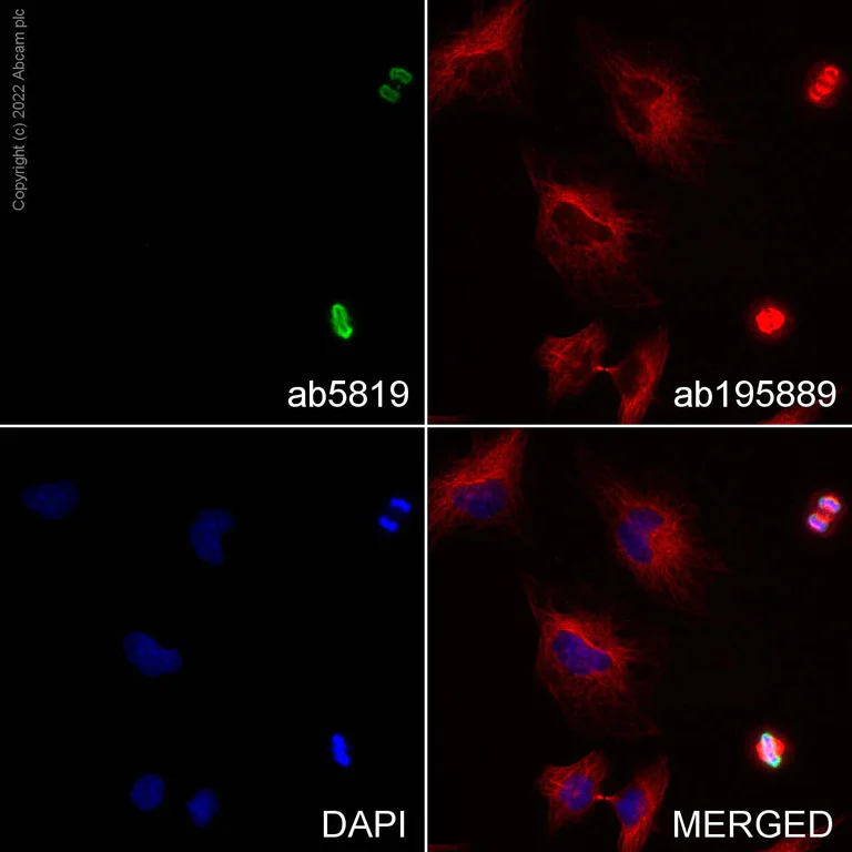 Immunocytochemistry/ Immunofluorescence - Anti-Histone H3 (tri methyl K9, phospho S10) antibody (AB5819)