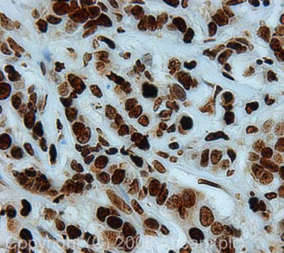 Immunohistochemistry (Formalin/PFA-fixed paraffin-embedded sections) - Anti-Histone H3 (tri methyl K9, phospho S10) antibody (AB5819)
