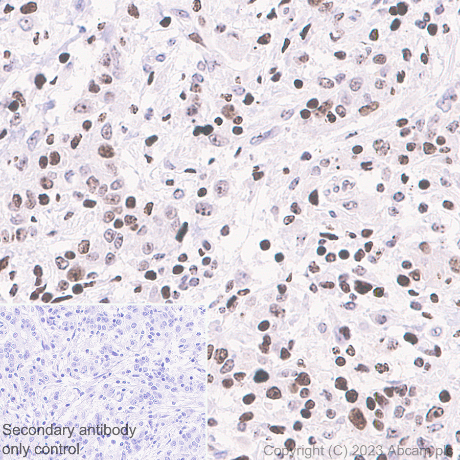 Immunohistochemistry (Formalin/PFA-fixed paraffin-embedded sections) - Anti-Histone H3 (unmodified K27) antibody [EPR23553-22] (ab308248), expandable thumbnail