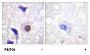 Immunohistochemistry (Formalin/PFA-fixed paraffin-embedded sections) - Anti-Histone H3.3 antibody (AB62642)