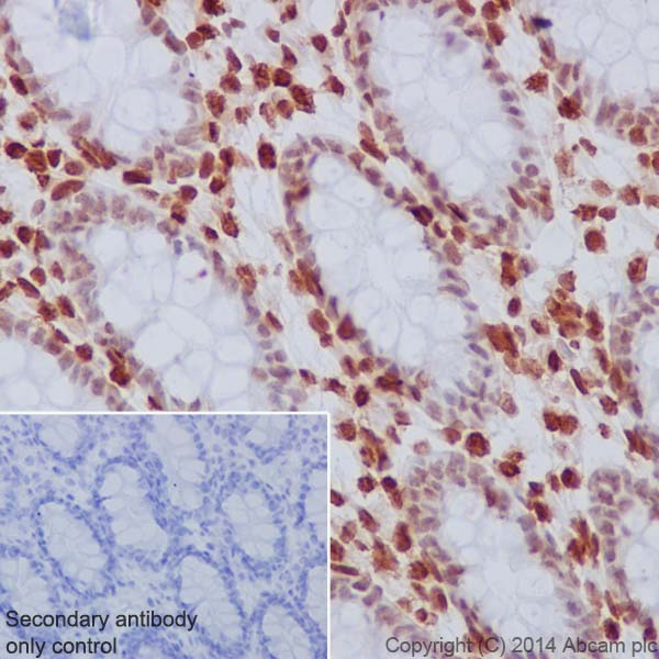 Immunohistochemistry (Formalin/PFA-fixed paraffin-embedded sections) - Anti-Histone H3.3 antibody [EPR17899] - ChIP Grade (AB176840)