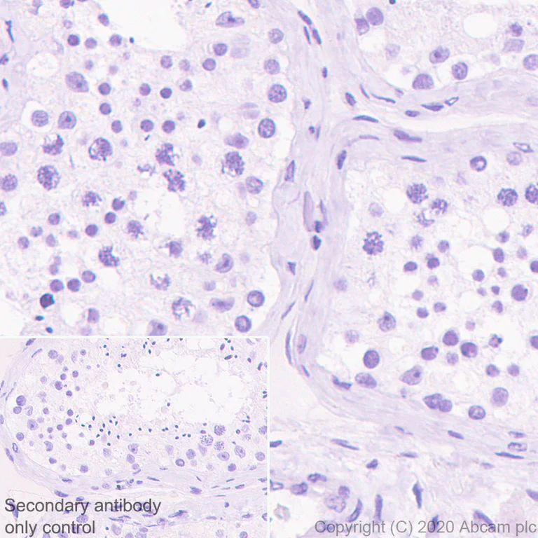 Immunohistochemistry (Formalin/PFA-fixed paraffin-embedded sections) - Anti-Histone H3.3 (mutated G34R) antibody [EPR23519-91] - ChIP Grade (AB254402)