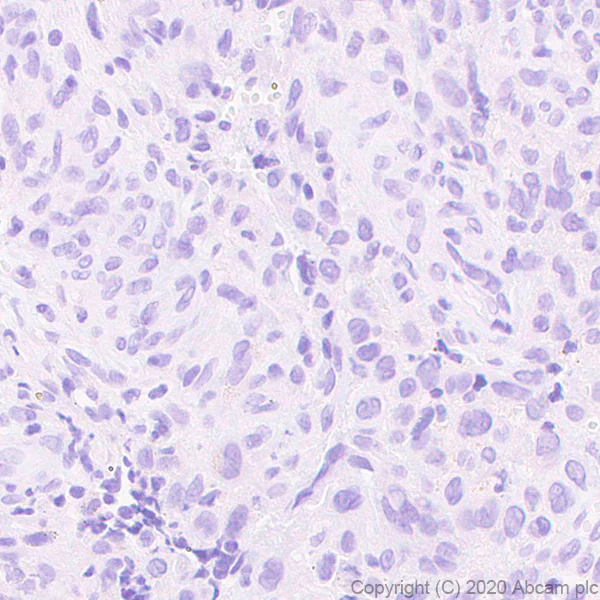 Immunohistochemistry (Formalin/PFA-fixed paraffin-embedded sections) - Anti-Histone H3.3 (mutated G34W) antibody [EPR23581-39] - ChIP Grade (AB272691)