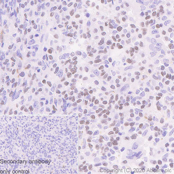 Immunohistochemistry (Formalin/PFA-fixed paraffin-embedded sections) - Anti-Histone H3.3 (mutated G34W) antibody [EPR23581-39] - ChIP Grade (AB272691)