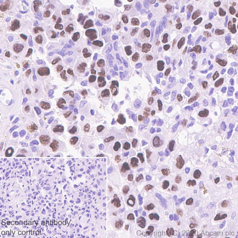 Immunohistochemistry (Formalin/PFA-fixed paraffin-embedded sections) - Anti-Histone H3.3 (mutated K36M) antibody [EPR23526-89] (AB254400)