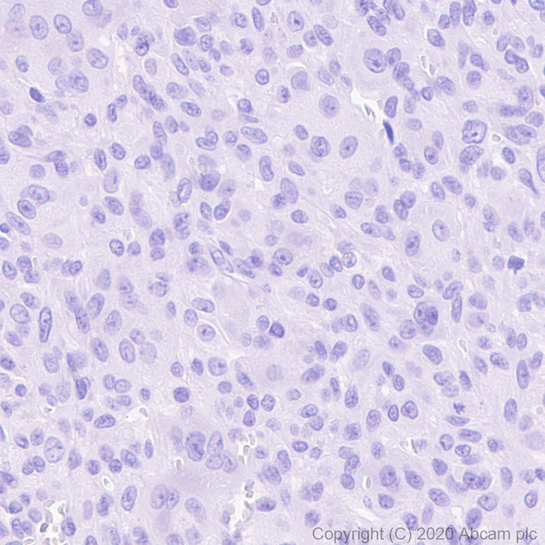 Immunohistochemistry (Formalin/PFA-fixed paraffin-embedded sections) - Anti-Histone H3.3 (mutated K36M) antibody [EPR23526-89] - BSA and Azide free (AB277487)