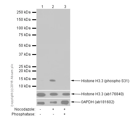 Western blot - Anti-Histone H3.3 (phospho S31) antibody [EPR1873] (AB92628)