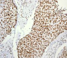 Immunohistochemistry (Formalin/PFA-fixed paraffin-embedded sections) - Anti-Histone H3.3 (phospho S31) antibody [EPR1873] - BSA and Azide free (AB183300), expandable thumbnail