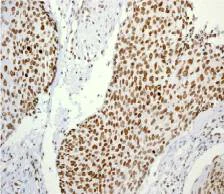 Immunohistochemistry (Formalin/PFA-fixed paraffin-embedded sections) - Anti-Histone H3.3 (phospho S31) antibody [EPR1873] - BSA and Azide free (AB183300)