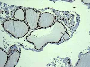 Immunohistochemistry (Formalin/PFA-fixed paraffin-embedded sections) - Anti-Histone H3.3C antibody [EPR10085(B)] (AB150417)