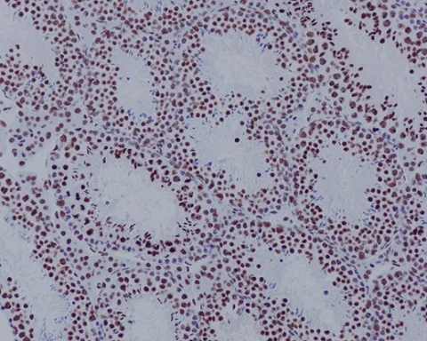 Immunohistochemistry (Formalin/PFA-fixed paraffin-embedded sections) - Anti-Histone H3.3C antibody [EPR10085(B)] (AB150417)