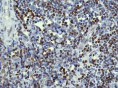 Immunohistochemistry (Formalin/PFA-fixed paraffin-embedded sections) - Anti-Histone H3.3C antibody [EPR10085(B)] (AB150417)