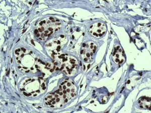 Immunohistochemistry (Formalin/PFA-fixed paraffin-embedded sections) - Anti-Histone H3.3C antibody [EPR10085(B)] (AB150417)
