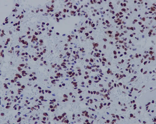 Immunohistochemistry (Formalin/PFA-fixed paraffin-embedded sections) - Anti-Histone H3.3C antibody [EPR10085(B)] - BSA and Azide free (AB177028)