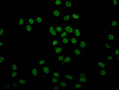 Immunocytochemistry/ Immunofluorescence - Anti-Histone H4 (2-hydroxyisobutyryl K8) antibody (AB241250)