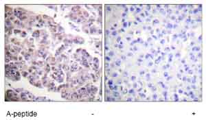 Immunohistochemistry (Formalin/PFA-fixed paraffin-embedded sections) - Anti-Histone H4 (acetyl K12) antibody (AB61238)