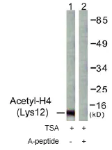 Western blot - Anti-Histone H4 (acetyl K12) antibody (AB61238)