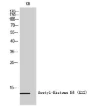 Western blot - Anti-Histone H4 (acetyl K12) antibody (AB61238)