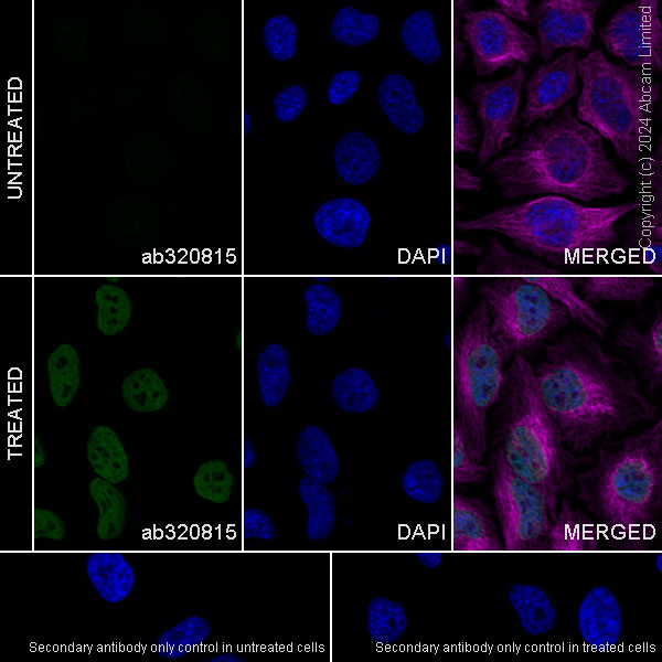 Immunocytochemistry/ Immunofluorescence - Anti-Histone H4 (acetyl K12) antibody [EPR28340-173] (AB320815), expandable thumbnail
