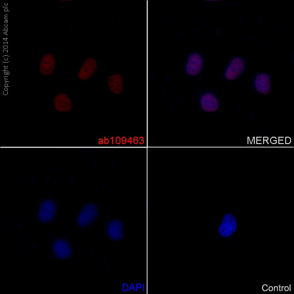 Immunocytochemistry/ Immunofluorescence - Anti-Histone H4 (acetyl K16) antibody [EPR1004] (ab109463), expandable thumbnail